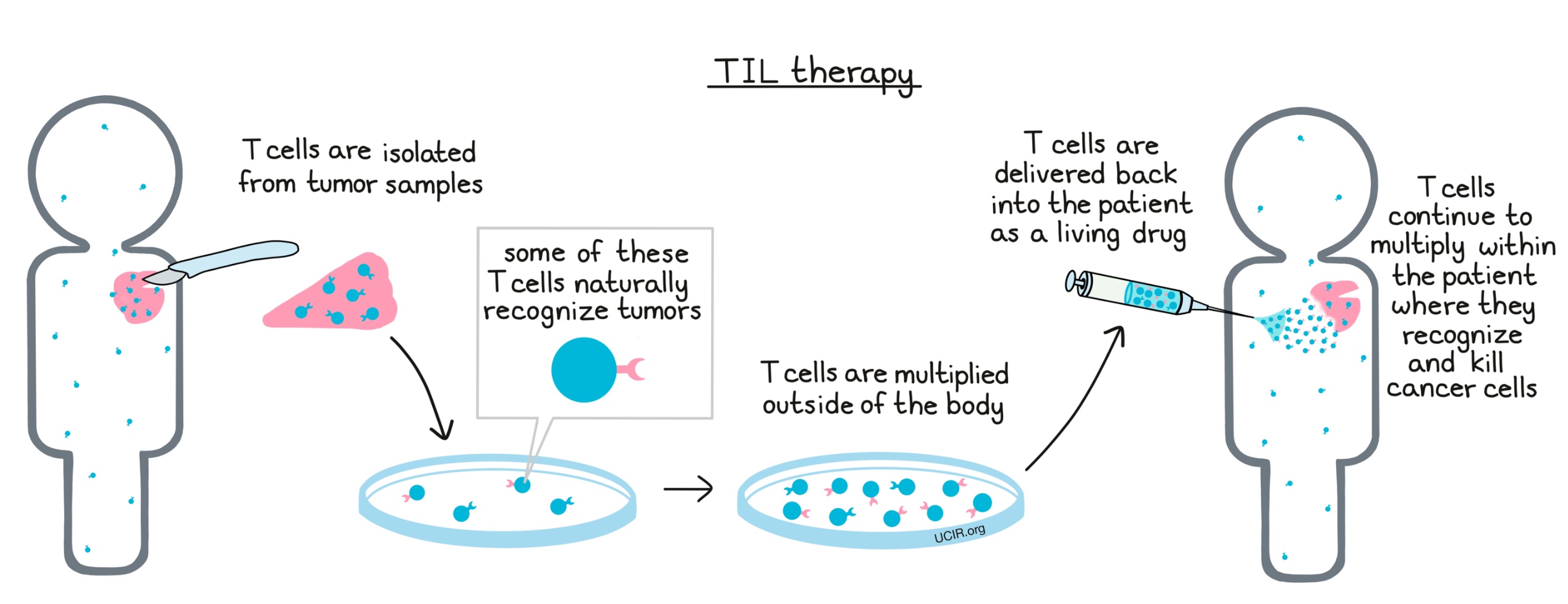 How TIL therapy works