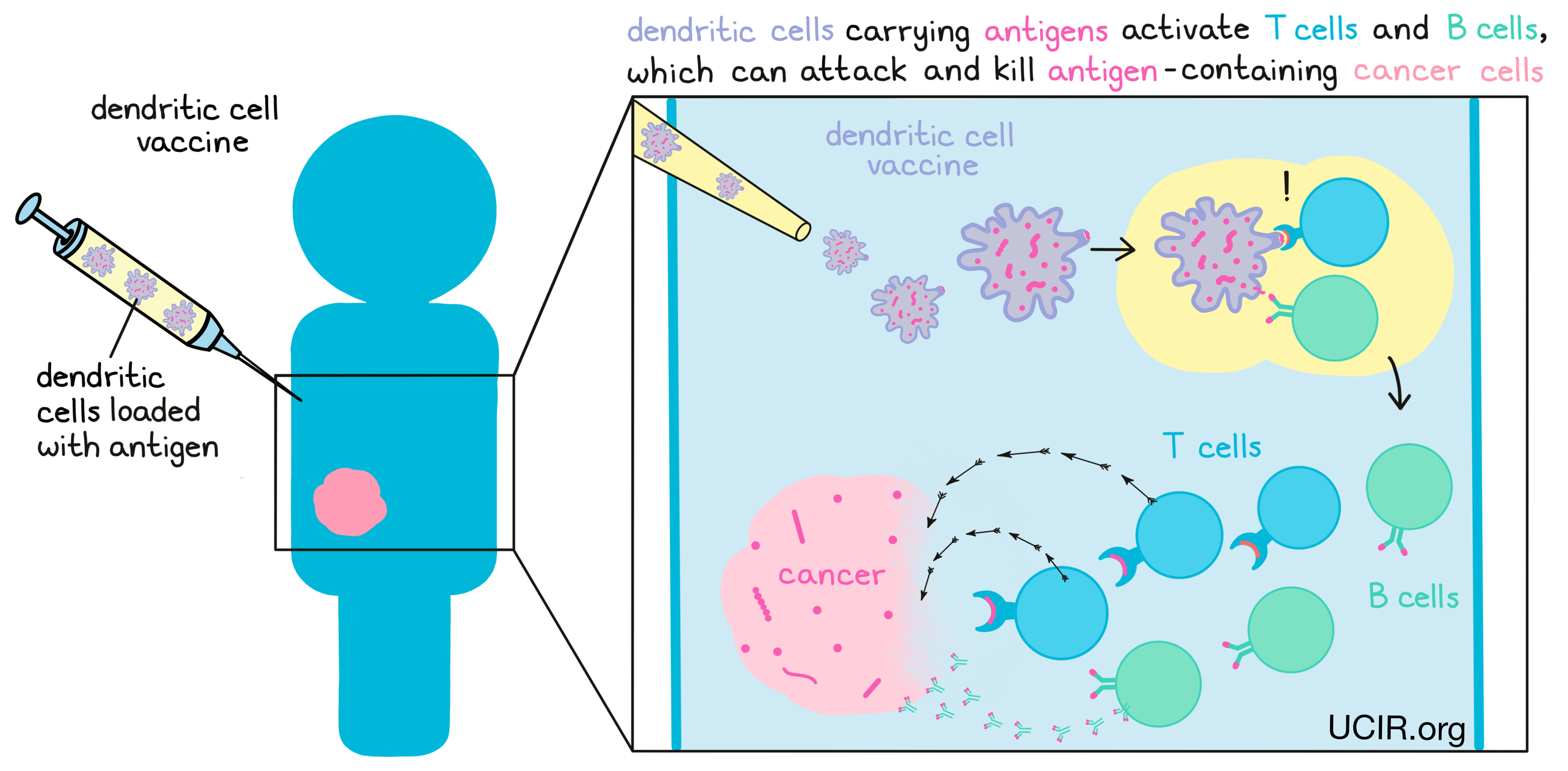 Illustration showing how DC vaccine works