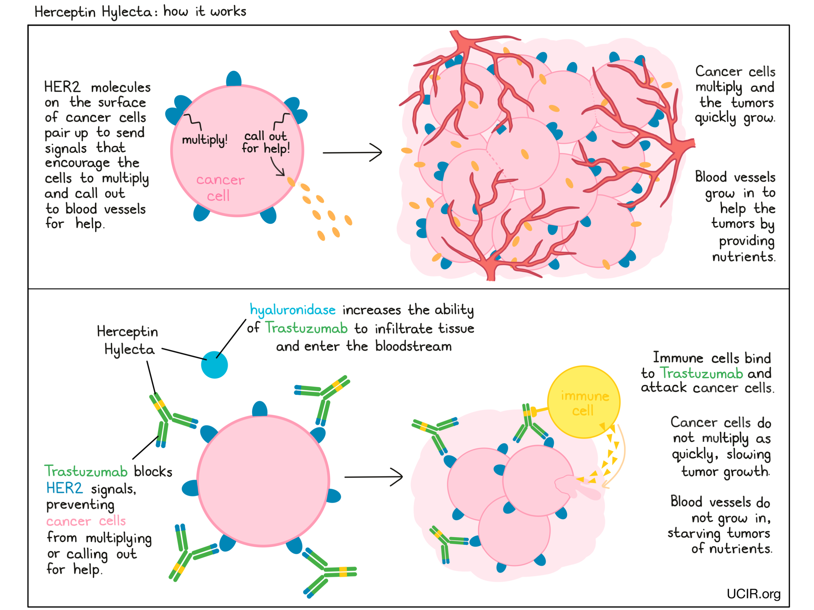 Illustration showing how Herceptin Hylecta works