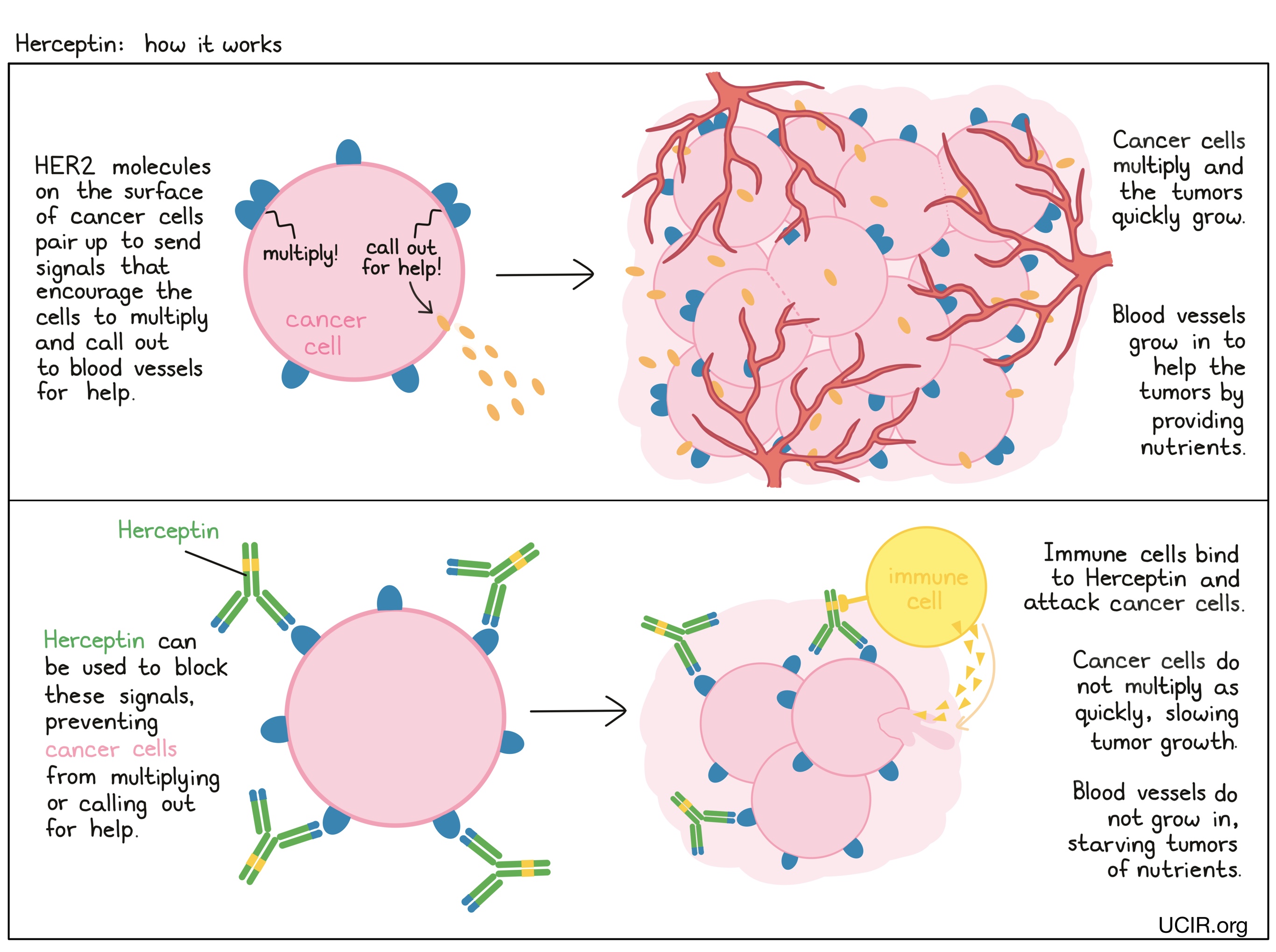 Illustration showing how Herceptin works
