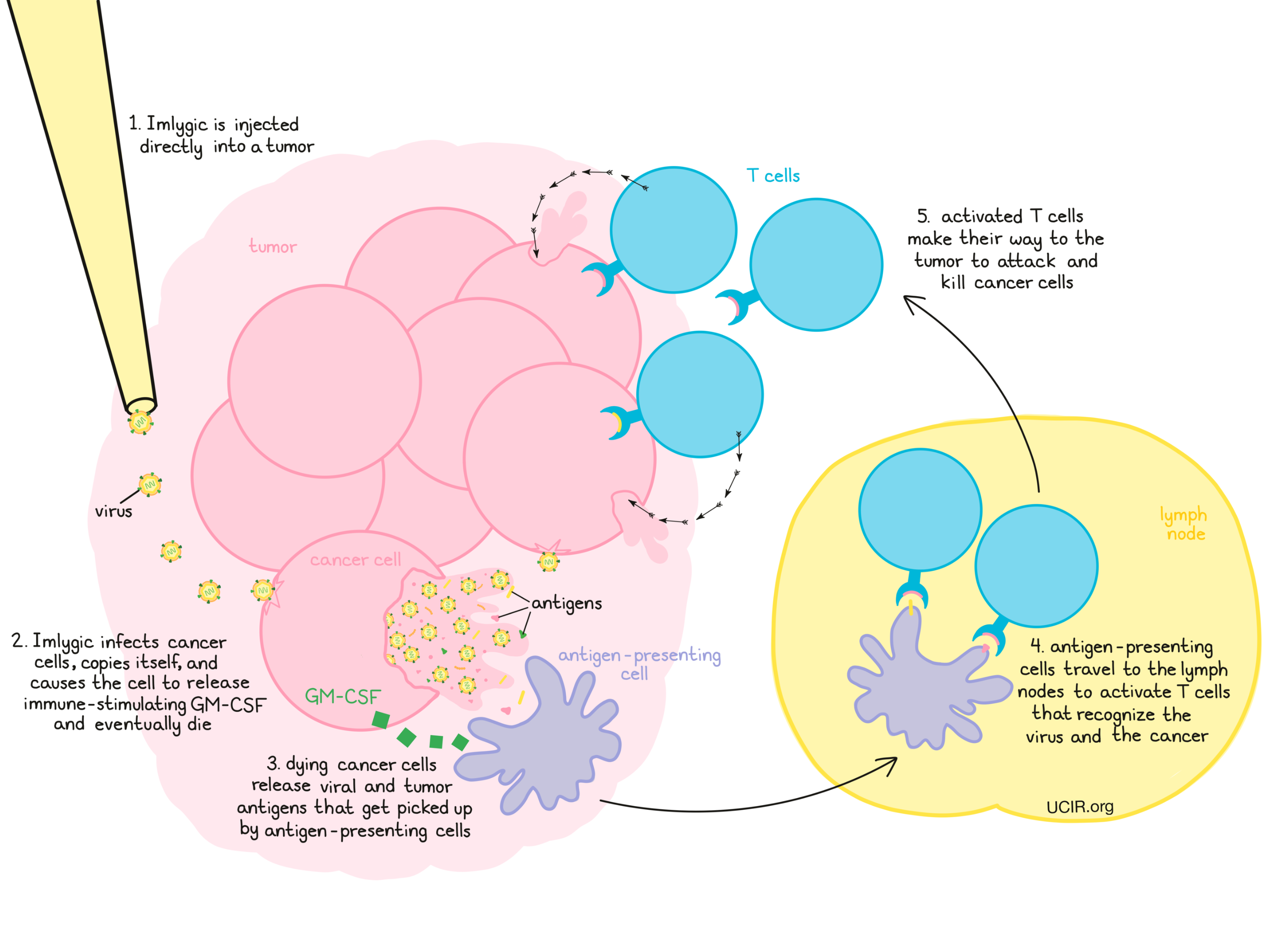 Illustration that shows how Imlygic works 