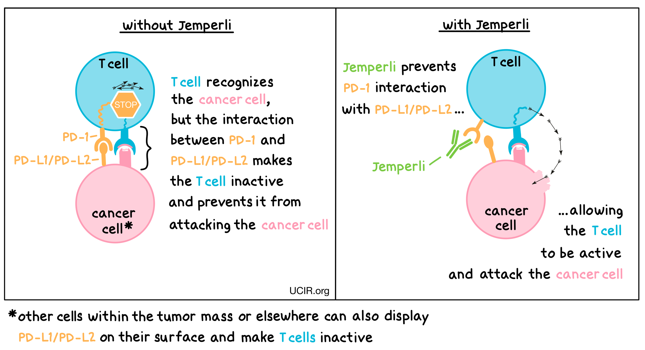 Illustration showing how Jemperli works