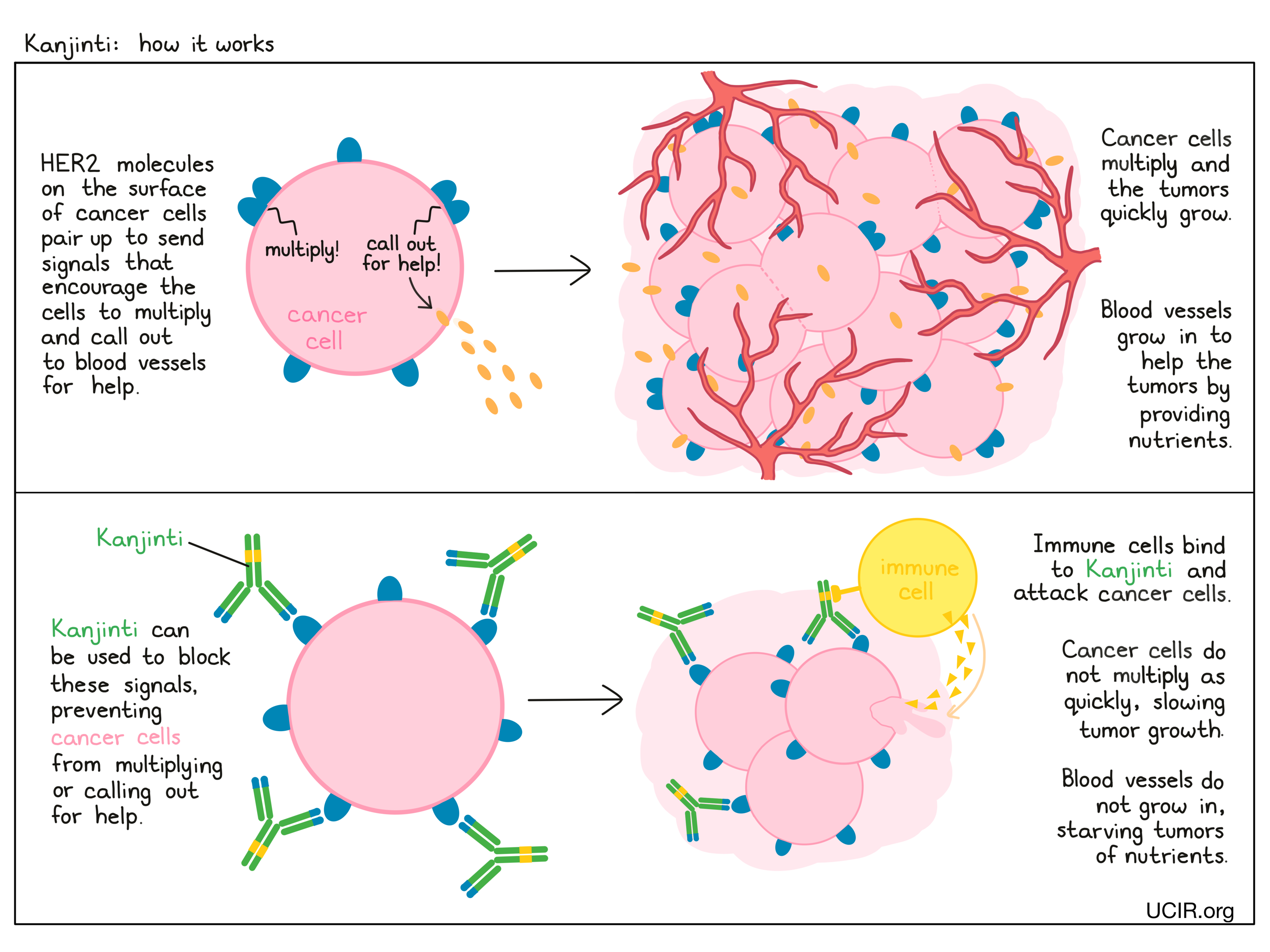 Illustration showing how Kanjinti works