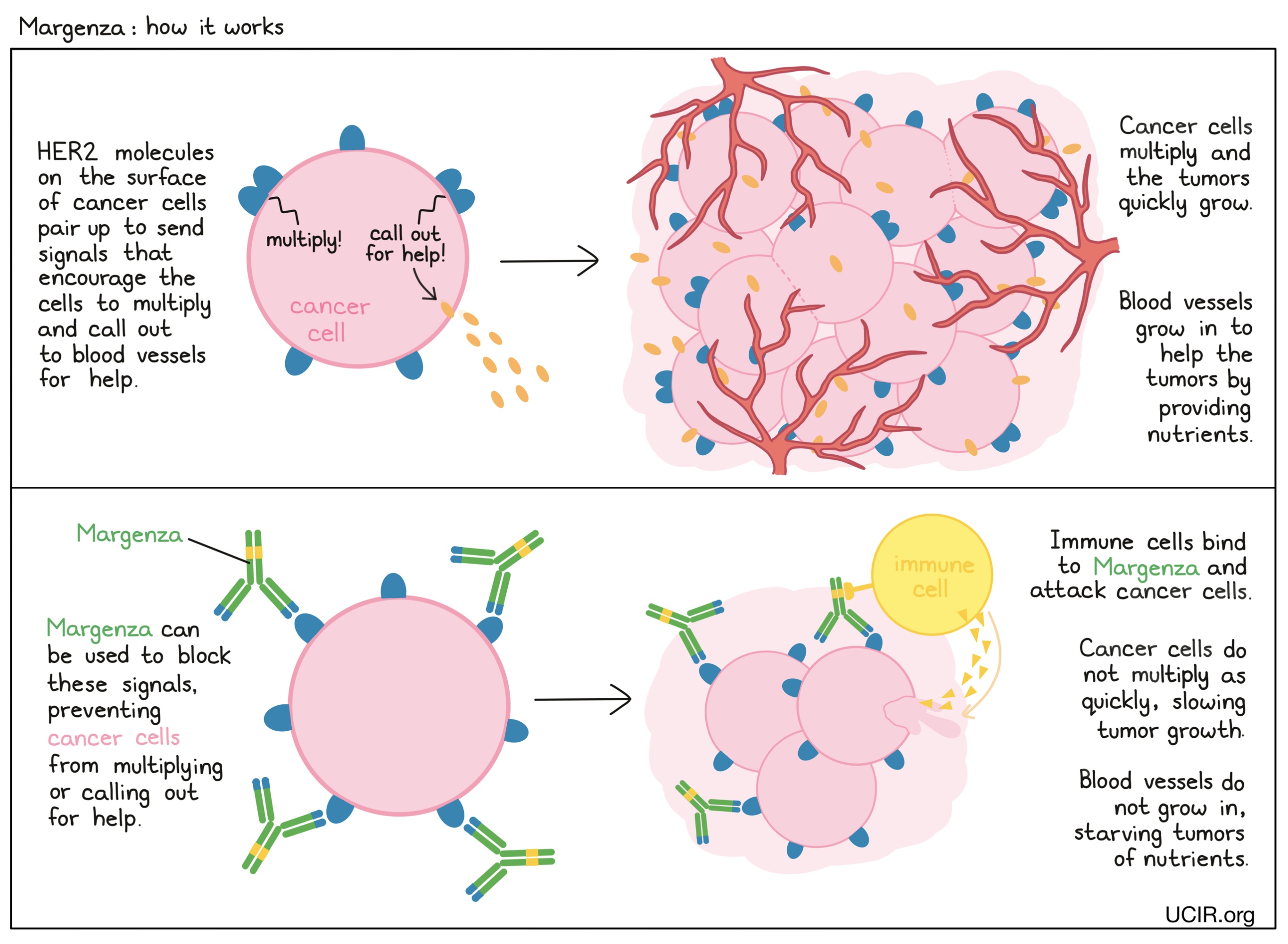 Illustration that shows how Margenza works